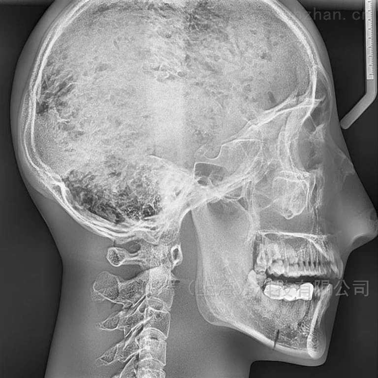 德国夸特QUART牙科X射线头部模体图片 4