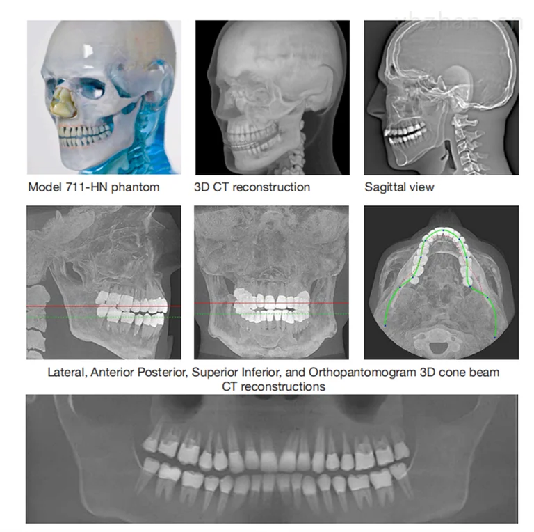 American CIRS 711-HN head phantom image 3