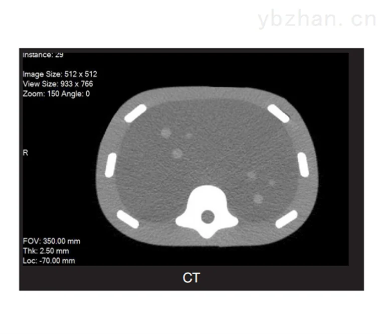 CIRS 071B image-guided abdominal puncture phantom product image 3
