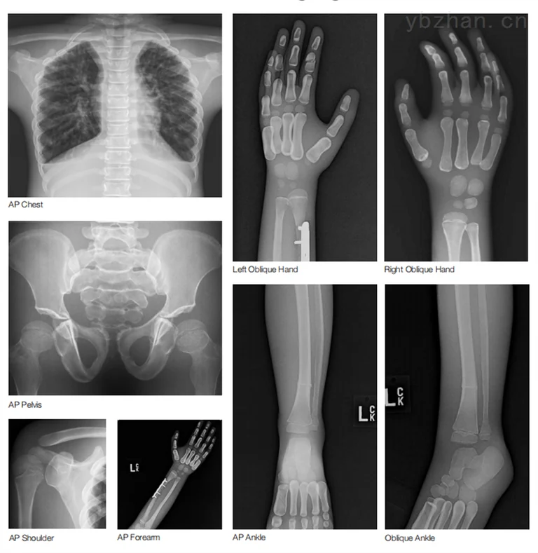美国CIRS 715儿科全身体模图片 3