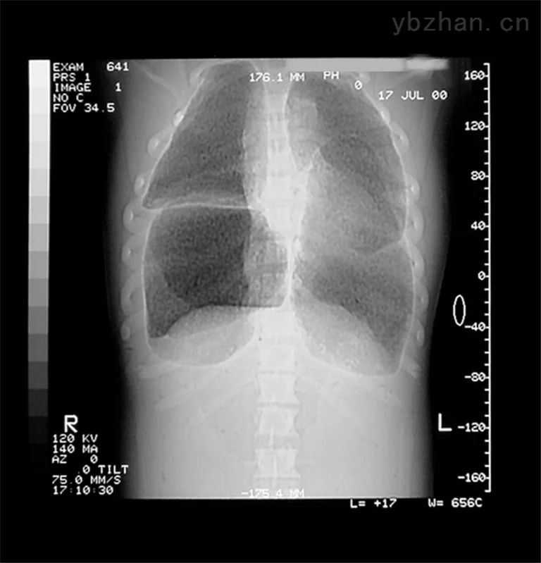 American CIRS 602 three-dimensional torso phantom image 3