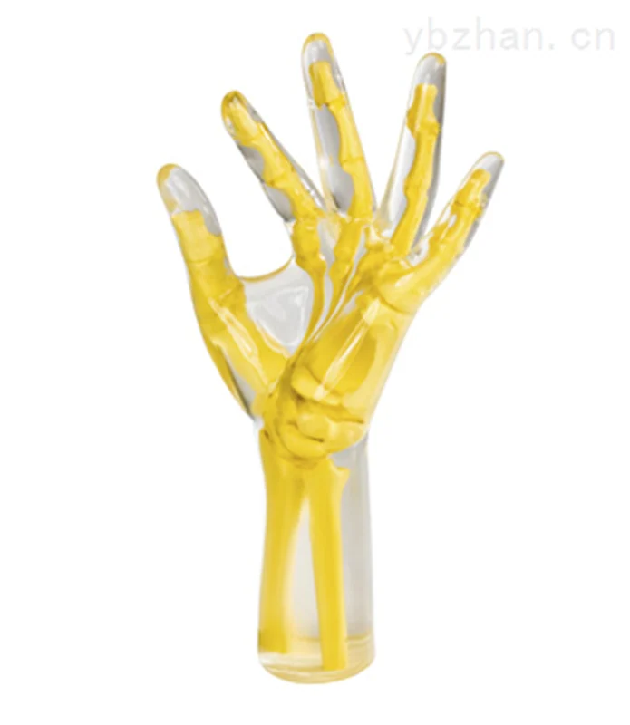 American RSD phantom hand/wrist model phantom image 2