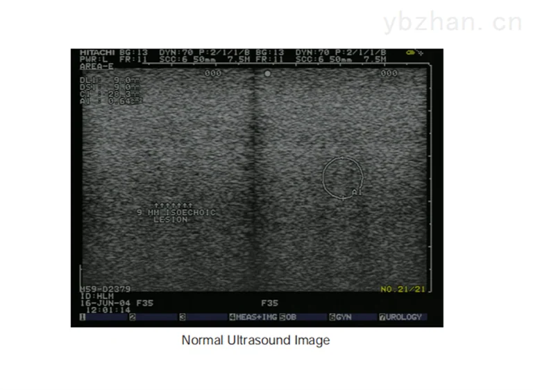 American CIRS 059 Ultrasound Breast Elastography Ultrasound Phantom image 3