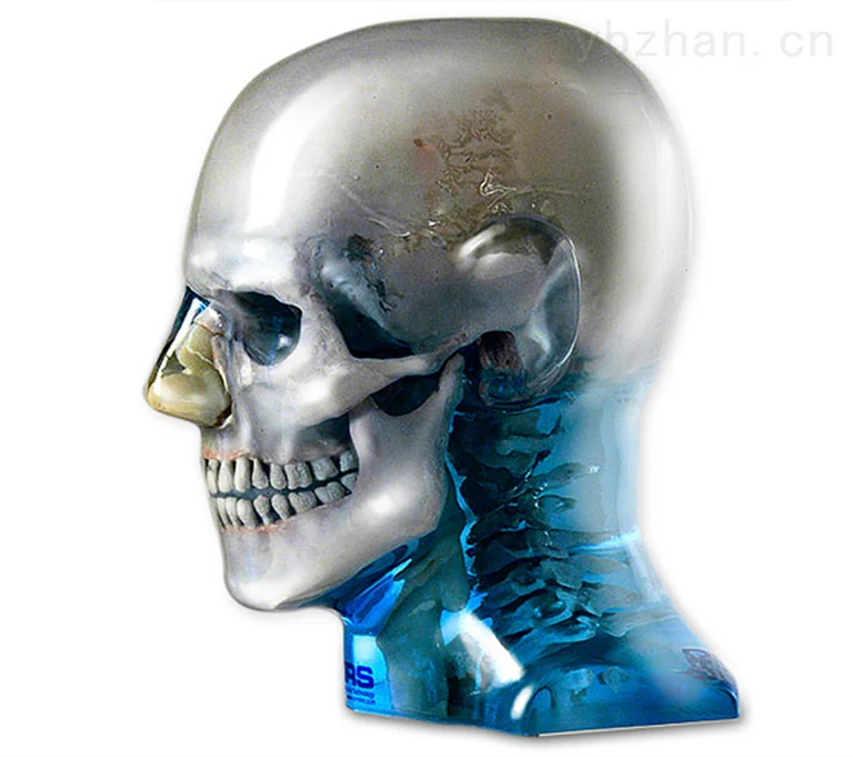 American CIRS 711-HN head phantom image 2