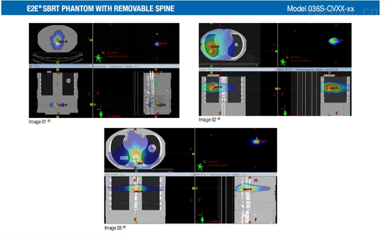 CIRS 036A-CVXX-XX radiotherapy test phantom image 3