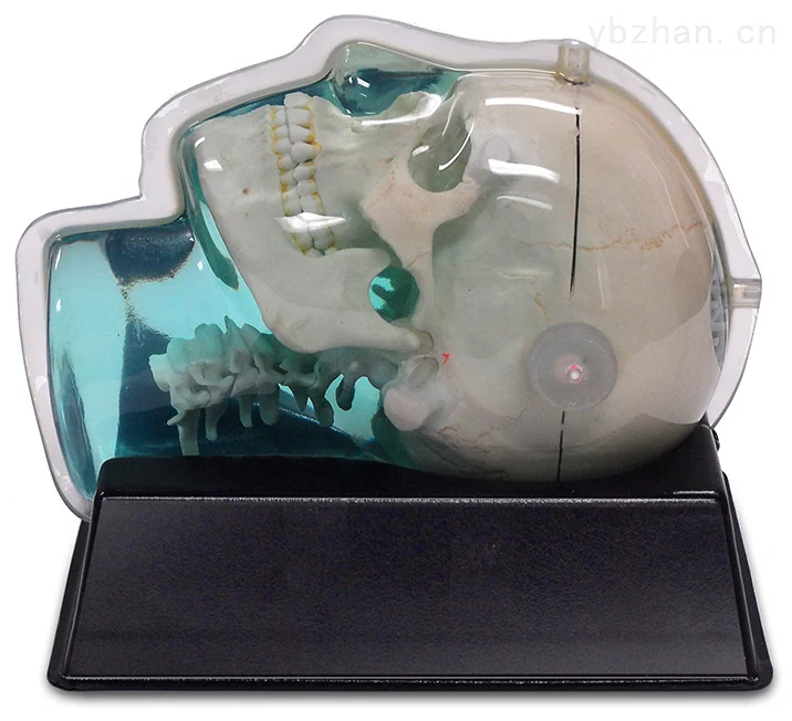 American CIRS 603A head phantom image